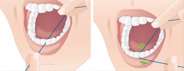 utilisation-fil-dentaire