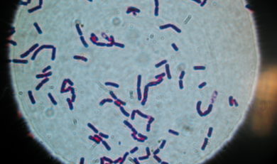 traitement bacillus cereus