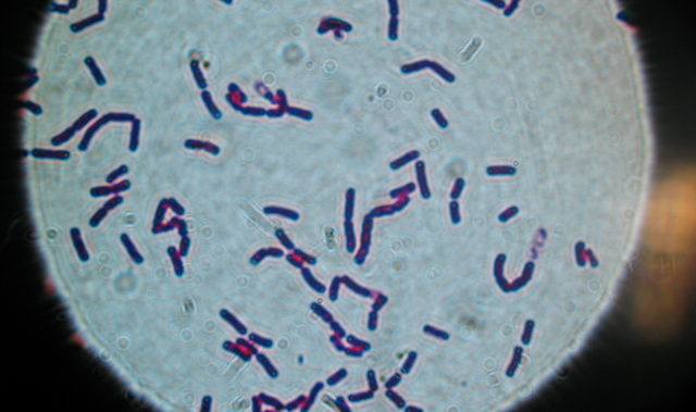 traitement bacillus cereus