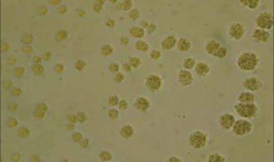 Ureaplasma urealyticum