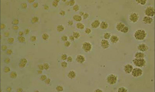 Ureaplasma urealyticum