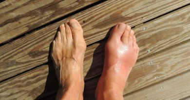 maladie pieds